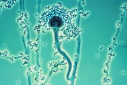 Aspergillus fumigatus